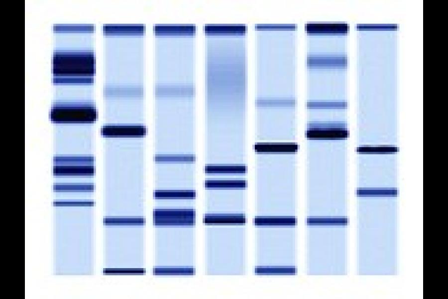 DAQN-sequencing-gel-close-up