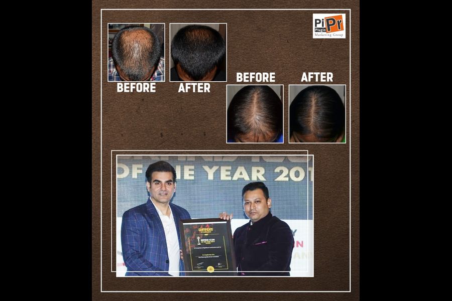 Dr. Snigdhodip Saha from Kolkata unfolds the mystery of Hairfall & Hair Regrowth treatment in India